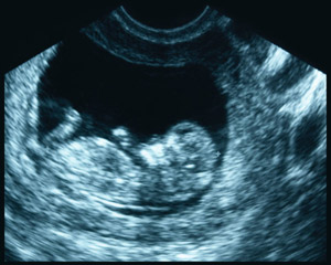 ultrasound-sm